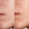 imageMAREE Star Pimple Patches for Face  Acne Patches  Natural Green Algae Extract ampamp Tea Tree Oil  Hydrocolloid Pimple Patches Cute Pimple Patches Stars for Cover Zit Patches Parches Para Acne 72 Patch