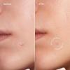 imageMAREE Pimple Patches for Face  Acne Clearing Device  Clear Acne Patches for Face  Invisible Hydrocolloid Patch Parches Para Acne Stickers Zit Dots  Cystic Zit Healing Blemish Pinple CoversClear