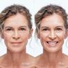 imageMAREE Blemish Toner Polishes  Daily Facial Radiance Toner Polish  Witch Hazel Pads Acne Face Toning  Acne Skin Care with BHA Salicylic Acid  Blemish Clearing Witch Hazel WipesBlemish Toner Pads