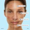 imageMAREE Glycolic Acid Toner 10 Facial Polish  Exfoliating Toner for Face  Glycolic Acid Toning Solution  Face Scalp ampamp Underarms Exfoliant Spray Alternative  Pure Acido Glicolico para Manchas