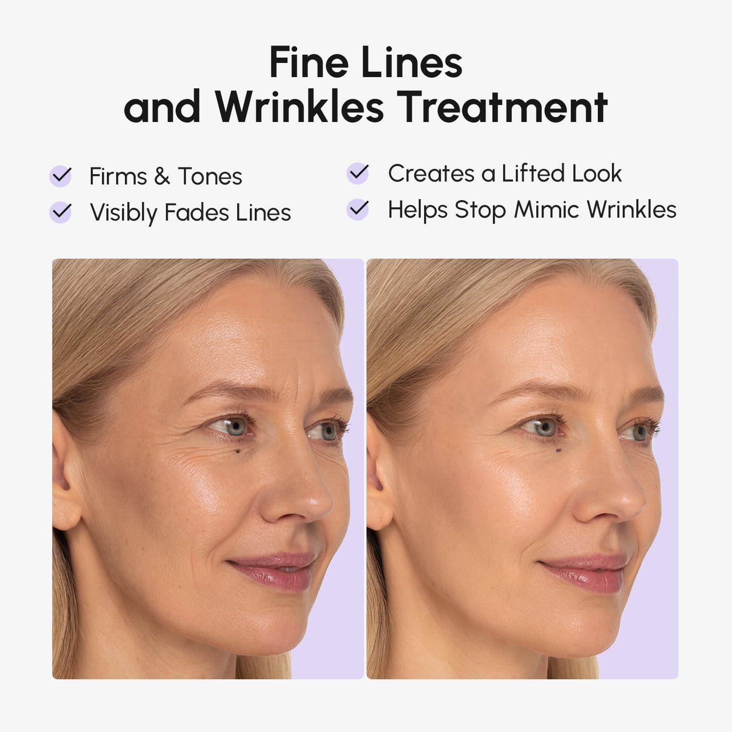 imageMAREE Face Lift Tape Wrinkle Patches  Smile Line Patches for Face Eyes Neck ampamp Forehead  Anti Wrinkle Patches for Lip  Face