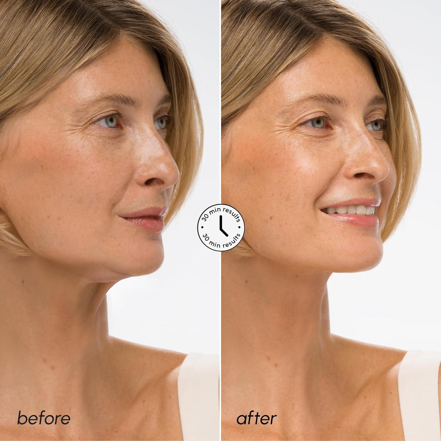 imageMAREE VLifting Mask Hyaluronic Acid Collagen  Gentle Hydration ampamp Comfort for All Skin Types