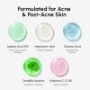 image:imageMAREE Glycolic Acid Pads  200 Toner Pads for Face Cleansing  Facial Exfoliating Pad with Tea Tree Oil Salicylic Acid amp Vitamins E B3 B5  Acne Clearing Face Pad Skin Pore Resurfacing amp RadianceAzelaic Pads