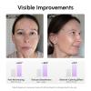 image:imageMAREE Vitamin C Toner Pads for Face  Brightening Facial Polishes with 20 Complex Vitamin C Collagen Niacinamide TXA  Facial Radiance Uneven Skin Tone Acne Clearing Pads  Glow Up Skincare DeviceNiacinamide Pads