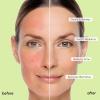 image:imageMAREE Vitamin C Toner Pads for Face  Brightening Facial Polishes with 20 Complex Vitamin C Collagen Niacinamide TXA  Facial Radiance Uneven Skin Tone Acne Clearing Pads  Glow Up Skincare DeviceBlemish Toner Pads