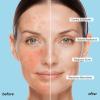 image:imageMAREE Vitamin C Toner Pads for Face  Brightening Facial Polishes with 20 Complex Vitamin C Collagen Niacinamide TXA  Facial Radiance Uneven Skin Tone Acne Clearing Pads  Glow Up Skincare DeviceGlycolic Pads
