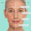 image:imageMAREE Vitamin C Toner Pads for Face  Brightening Facial Polishes with 20 Complex Vitamin C Collagen Niacinamide TXA  Facial Radiance Uneven Skin Tone Acne Clearing Pads  Glow Up Skincare DeviceAzelaic Pads