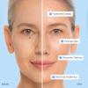 image:imageMAREE Hyaluronic Acid Toner Pads  Hydrating Face Wipes for Women Cleansing  Zero Pore Toning Brightening Exfoliating Face Pads  Pore Reducer Facial Peels  Acne Treatment DeviceSky Blue