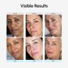 image:imageMAREE TXA Tranexamic Acid Serum Cream with Microspicules 100000 PPM Complex  Alpha Arbutin Cream  Face Crema para Manchas Oscuras en la CaraBlue