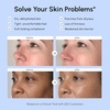 image:imageMAREE Face Moisturizer  Retinol Face Cream for Women Moisturizing with Collagen amp Hyaluronic Acid  Day amp Night AntiAging Facial Wrinkle DD Cream Moisturizer for Dry Skin  Crema Para la CaraGold