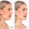 image:imageMAREE V Line Lifting Mask with 24K Gold  Deep Collagen Face Mask for Women  Jawline Shaper Mask with Retinol amp Hyaluronic Acid  Neck Tightening amp Firming  Double Chin Strap for Face Lift  2 packGold