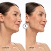 image:imageMAREE V Line Lifting Mask with 24K Gold  Deep Collagen Face Mask for Women  Jawline Shaper Mask with Retinol amp Hyaluronic Acid  Neck Tightening amp Firming  Double Chin Strap for Face Lift  2 packSalmon