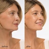 image:imageMAREE V Line Lifting Mask with 24K Gold  Deep Collagen Face Mask for Women  Jawline Shaper Mask with Retinol amp Hyaluronic Acid  Neck Tightening amp Firming  Double Chin Strap for Face Lift  2 packPurple