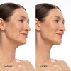 image:imageMAREE V Line Lifting Mask with 24K Gold  Deep Collagen Face Mask for Women  Jawline Shaper Mask with Retinol amp Hyaluronic Acid  Neck Tightening amp Firming  Double Chin Strap for Face Lift  2 packSalmon