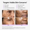 image:imageMAREE Dark Spot Remover for Face and Body  Dark Spot Corrector Serum  Hyperpigmentation Melasma Sun amp Age Spots  Black amp Brown Spot Remover for Women  Deep Hydration Body amp Face Serum