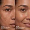 image:imageMAREE Kojic Acid Soap amp Scrub  Brightening Kojic Acid and Turmeric Soap for Dark Spot and Hyperpigmentation  Dark Spot Remover for Face amp Body Wash  Acido Kojico Cream Bar Soaps