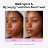 image:imageMAREE PDRN Serum  Peptides Serum for Face AntiAging  Salmon DNA Face Serum with Retinol Niacinamide amp Collagen  Hydrating Facial Serums for Women  Glass Skin Glow Wrinkle Care MoisturizerTranexamic