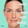 image:imageMAREE PDRN Serum  Peptides Serum for Face AntiAging  Salmon DNA Face Serum with Retinol Niacinamide amp Collagen  Hydrating Facial Serums for Women  Glass Skin Glow Wrinkle Care MoisturizerAzelaic