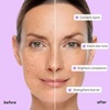 image:imageMAREE PDRN Serum  Peptides Serum for Face AntiAging  Salmon DNA Face Serum with Retinol Niacinamide amp Collagen  Hydrating Facial Serums for Women  Glass Skin Glow Wrinkle Care MoisturizerTranexamic