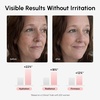 image:imageMAREE PDRN Serum  Peptides Serum for Face AntiAging  Salmon DNA Face Serum with Retinol Niacinamide amp Collagen  Hydrating Facial Serums for Women  Glass Skin Glow Wrinkle Care MoisturizerPDRN